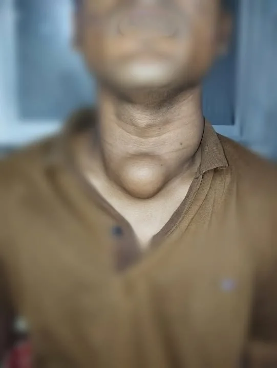 Neck lump assessment by Prof. Dr. Muhammad Irshad Malik