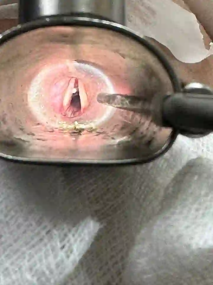 Throat and voice care by Prof. Dr. Muhammad Irshad Malik