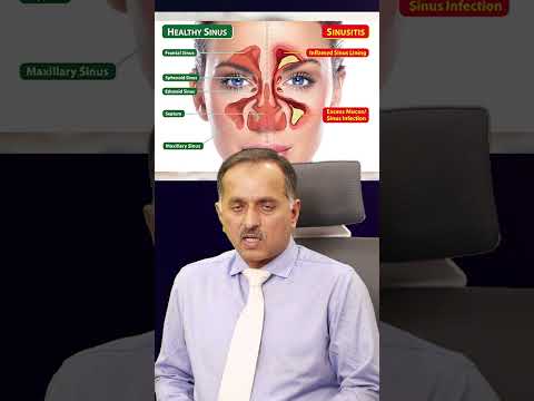 How sinus infection is diagnosed — ENT education video