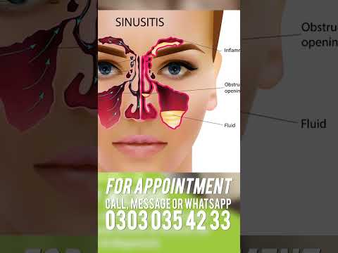 What causes sinus infection — ENT specialist explanation